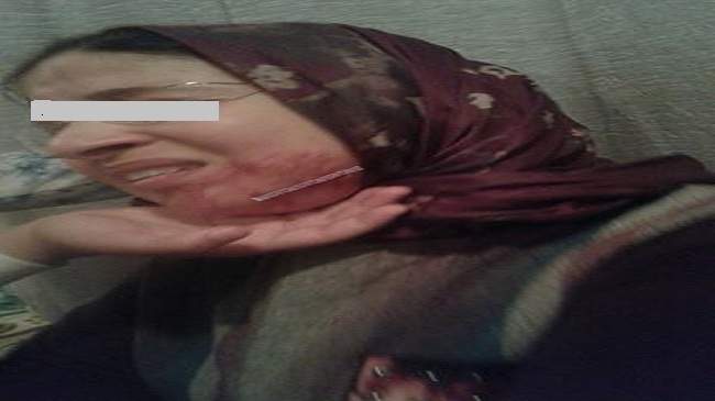 أستاذة تتعرض لاعتداء شنيع بسكين من قبل تلميذ في الحي المحمدي